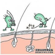 大连腋臭在夏季怎么护理