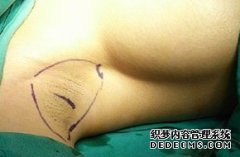 大连引起狐臭的原因有哪些