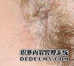 大连大学生夏天穿紧身衣会得狐臭吗
