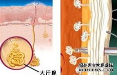 大连狐臭来源于何方,狐臭的病因有哪些呢